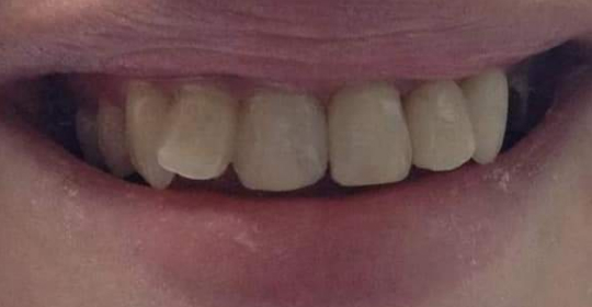 After smile treatment at Downtown Dental and Implantss of Oswego,Inc