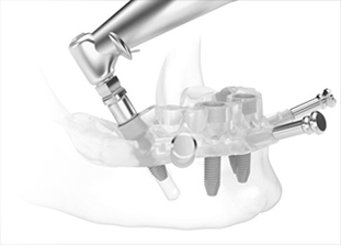 Dental technology