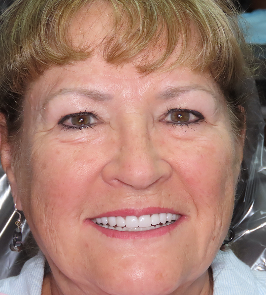 Cathy FMR - Post 1